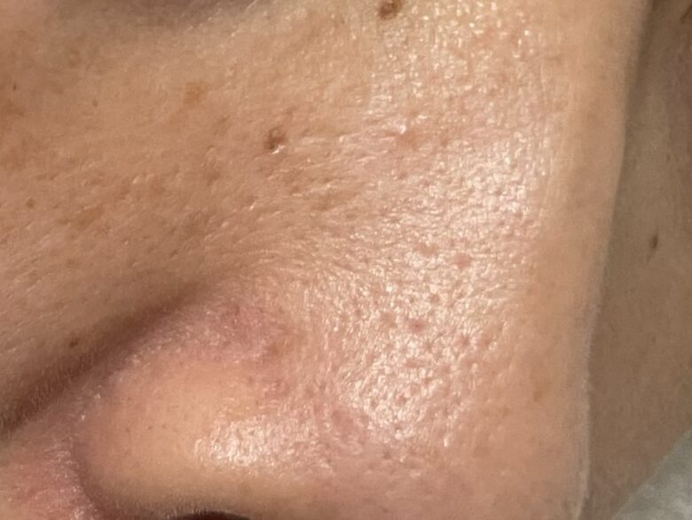 【ぽろぽろとれる杏ジェル】使用前