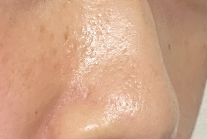 【ぽろぽろとれる杏ジェル】使用後